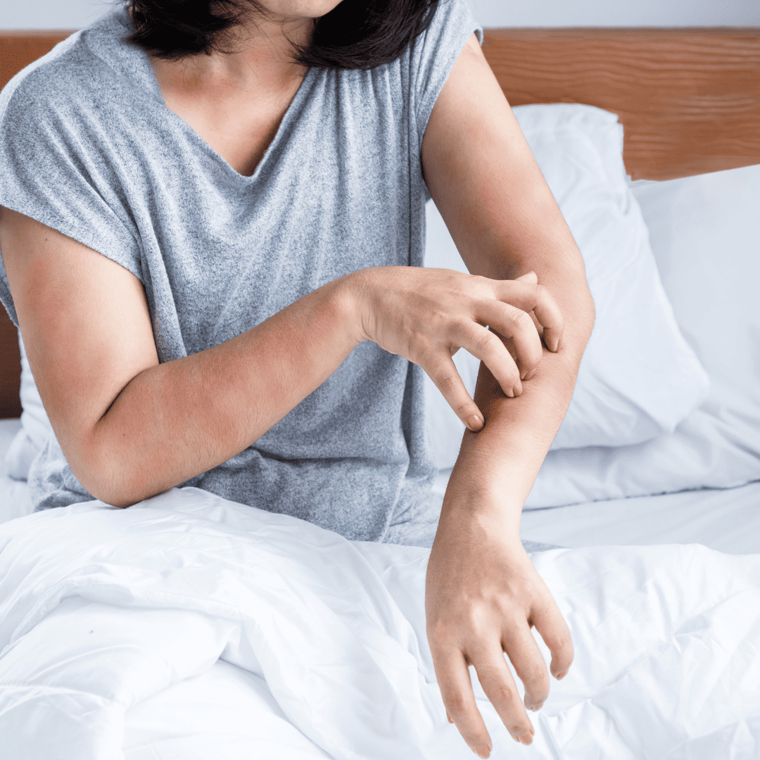 Bed Bug Heat Treatment 11 Itching or Allergies | Bed Bug Texas Termite & Pest Control